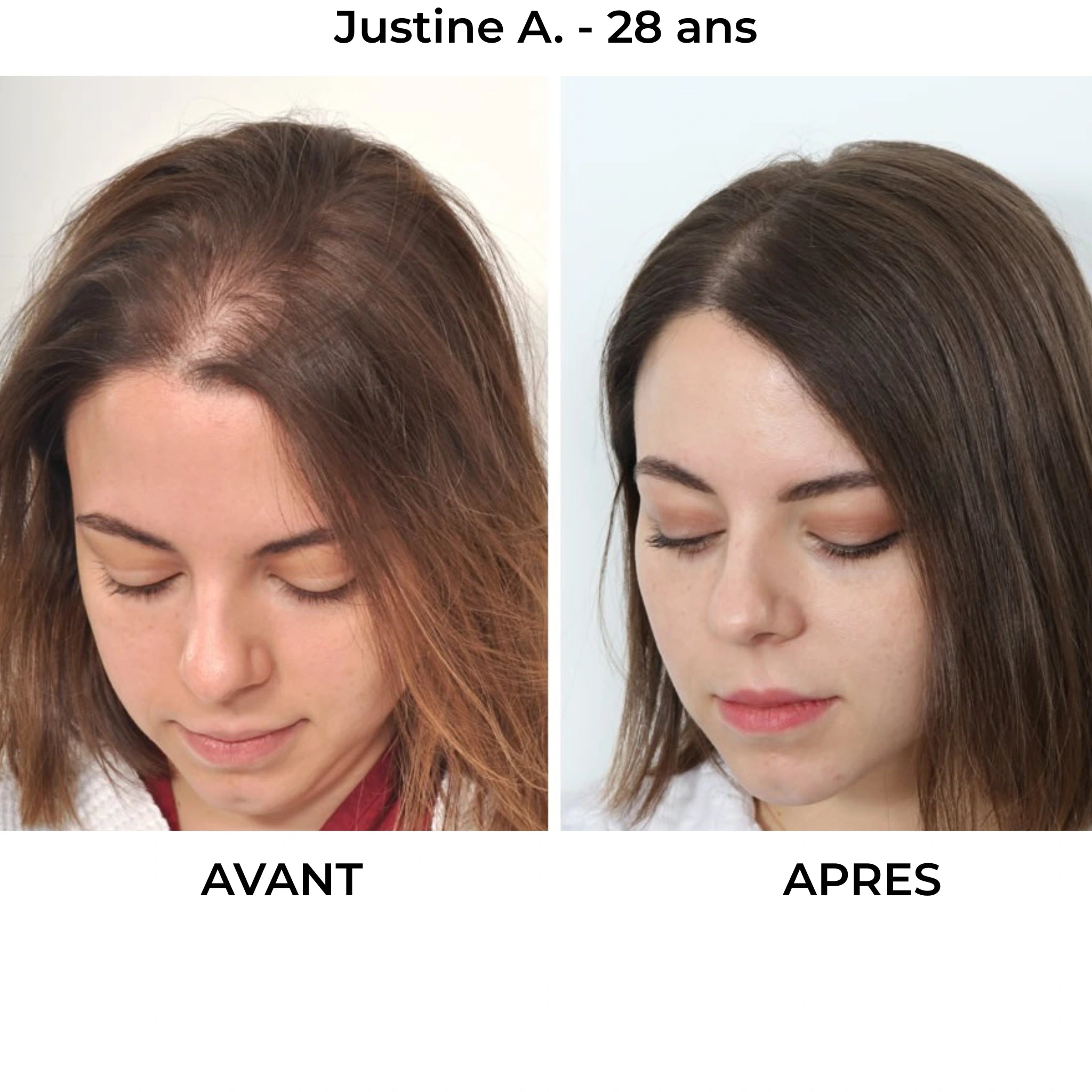 Rituel Capillaire - Herbelya – Finissez-en avec les cheveux fragiles et cassants