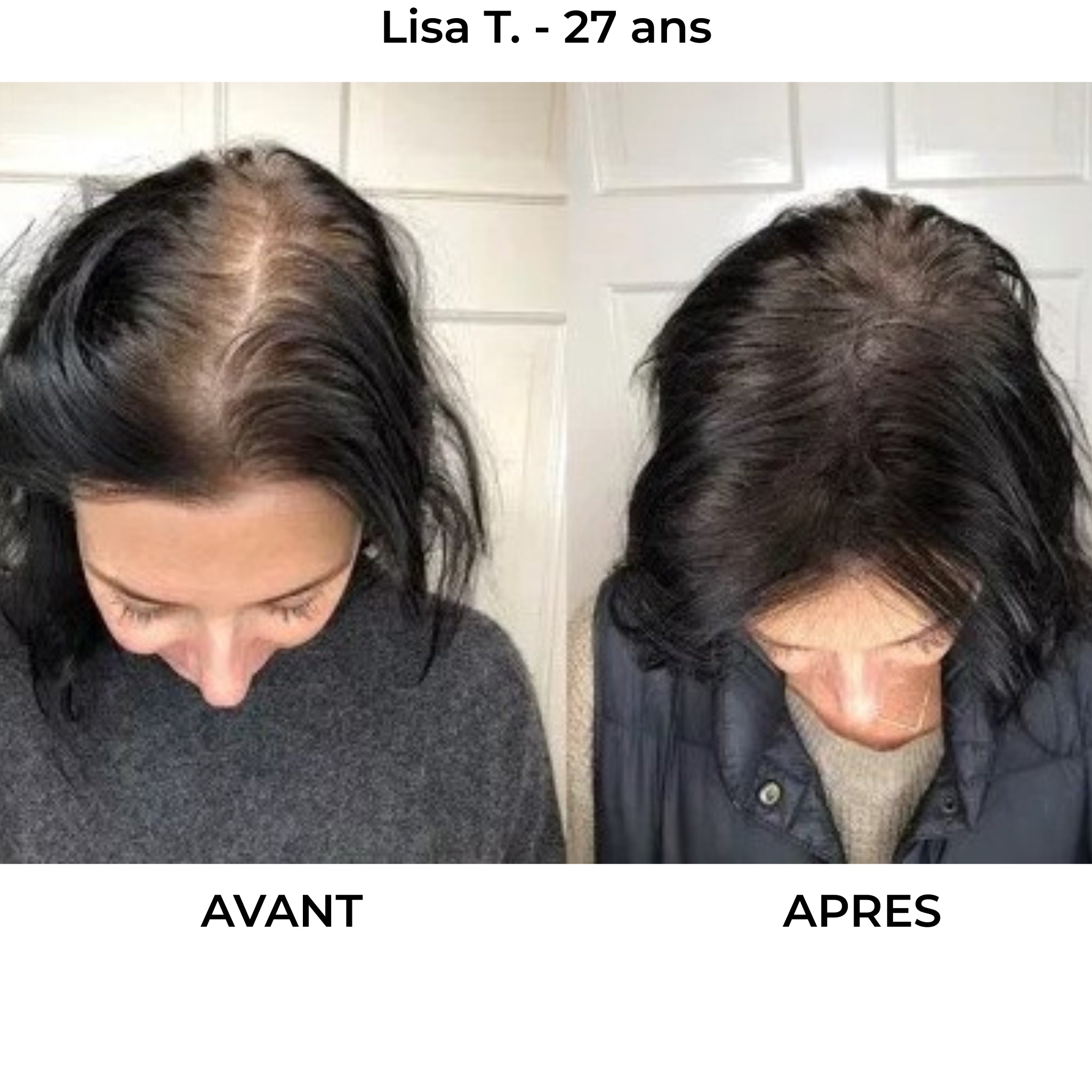 Rituel Capillaire - Herbelya – Finissez-en avec les cheveux fragiles et cassants