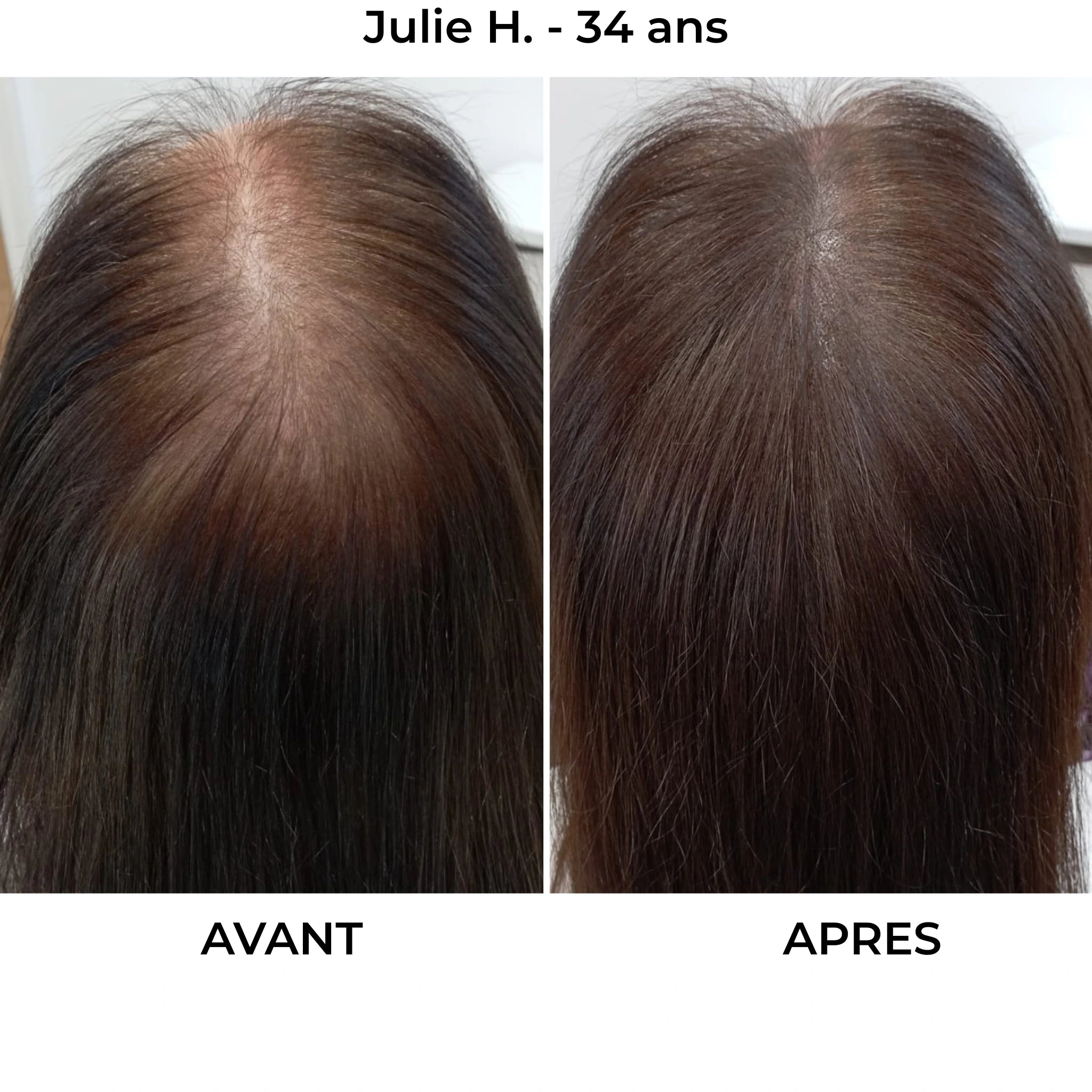 Rituel Capillaire - Herbelya – Finissez-en avec les cheveux fragiles et cassants