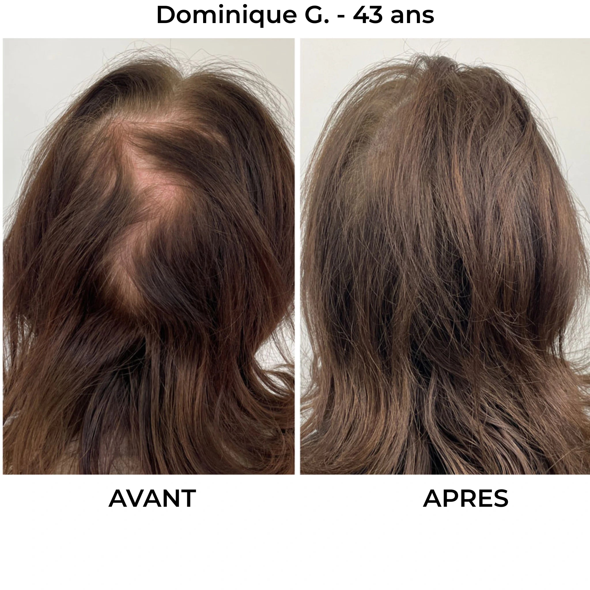 Rituel Capillaire - Herbelya – Finissez-en avec les cheveux fragiles et cassants